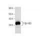 17β-HSD Antibody (A-5) - Western Blotting - Image 158375