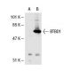 BTBD1 Antibody (35.1) - Western Blotting - Image 31622
