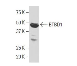 BTBD1 Antibody (35.1) - Western Blotting - Image 34360 