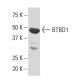 BTBD1 Antibody (35.1) - Western Blotting - Image 34360 