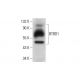 BTBD1 Antibody (A-12) - Western Blotting - Image 303905 