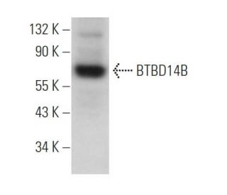 BTBD14B Antibody (E-3) - Western Blotting - Image 371730The Double Nickase Plasmid features a U6 promoter for sgRNA expression, a 20 nt targeting sequence, and a gRNA scaffold to guide Cas9n. It includes a CBh promoter for Cas9n (D10A) and puromycin resistance, GFP for transfection verification, and nuclear localization signals (NLS). The 2A peptide allows co-expression of Cas9n and Puro from a single promoter, enabling precise genome editing with reduced off-target effects.