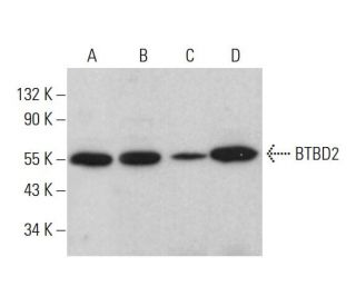 BTBD2 Antibody (H-2) - Western Blotting - Image 385236 