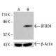 BTBD4 Antibody (C-5) - Western Blotting - Image 415033