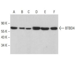 BTBD4 Antibody (C-5) - Western Blotting - Image 381381Each CRISPR/Cas9 Knockout (KO) Plasmid product consists of a pool of 3 plasmids designed to ensure identification and cleavage of a specific gene for maximum knockout efficiency. Each plasmid encodes a unique 20 nt sequence derived from the GeCKO (v2) library.