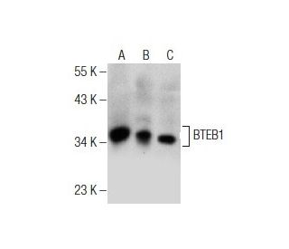 western blotting image from recommended BTEB1 (A-5) monoclonal antibody replacement. Image 155605