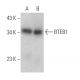 BTEB1 Antibody (E-8) - Western Blotting - Image 373491