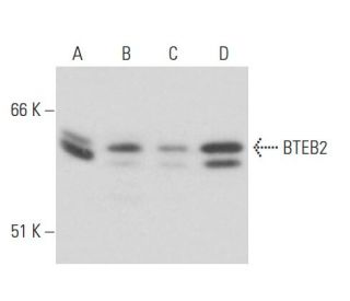 BTEB2 Antibody (10B3) - Western Blotting - Image 17469 