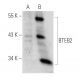 BTEB2 Antibody (10B3) - Western Blotting - Image 40869