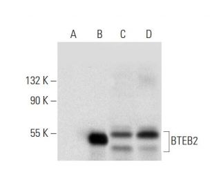 western blotting image from recommended BTEB2 (G-7) monoclonal antibody replacement. Image 304940