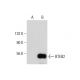 BTEB2 Antibody (A-5) - Western Blotting - Image 300455