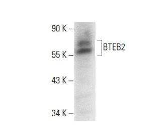 BTEB2 Antibody (A-5) - Western Blotting - Image 300606 