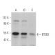 BTEB2 Antibody (B-8) - Western Blotting - Image 363480