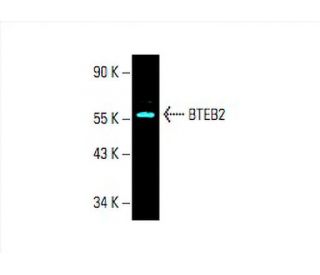 BTEB2 Antibody (G-7) - Western Blotting - Image 394842 