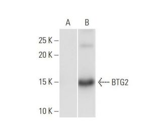 BTG2 Antibody (1A5) - Western Blotting - Image 352160 
