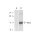 This polyclonal antibody has been discontinued. See our recommended <a href="btg2-antibody-1a5">BTG2 (1A5)</a> monoclonal antibody (sample data shown). western blotting image from recommended BTG2 (1A5) monoclonal antibody replacement. Image 352160