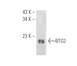 BTG2 Antibody (E-4) - Western Blotting - Image 395670SAM Transcription Activation: SAM system utilizing dCas9-VP64, MS2-P65-HSF1, and sgRNA for precise gene transcription activation.