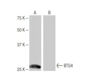 BTG4 Antibody (NB-B3) - Western Blotting - Image 64876SAM Transcription Activation: SAM system utilizing dCas9-VP64, MS2-P65-HSF1, and sgRNA for precise gene transcription activation.