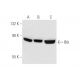 Btk Antibody (DFS) - Western Blotting - Image 57978 