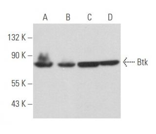 Btk Antibody (DFS) - Western Blotting - Image 357434 