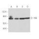 Btk Antibody (DFS) - Western Blotting - Image 357434 