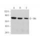 Btk Antibody (DFS) - Western Blotting - Image 361529