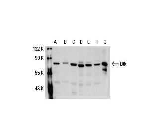 Btk Antibody (DFW) - Western Blotting - Image 19299 