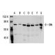Btk Antibody (DFW) - Western Blotting - Image 19299 