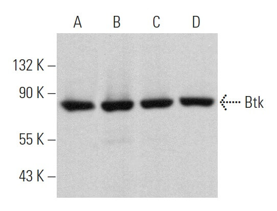 人気スポー新作 | (E-9) Antibody Btk SCBT Biotechnology Cruz Santa - アイドル