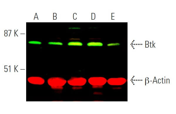 Btk Antibody (E-9) | SCBT - Santa Cruz Biotechnology