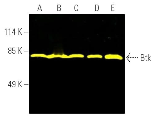 Btk Antibody (E-9) | SCBT - Santa Cruz Biotechnology