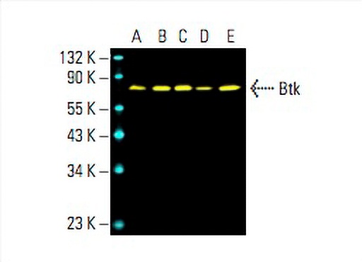 Btk Antibody (E-9) | SCBT - Santa Cruz Biotechnology