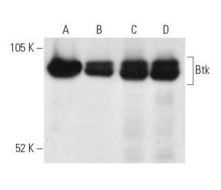 western blotting image from recommended Btk (E-9) monoclonal antibody replacement. Image 9926