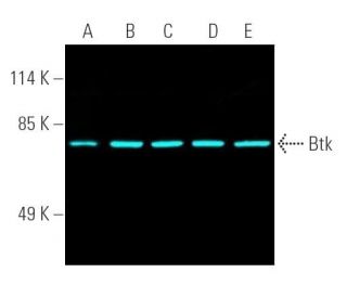 Btk Antibody (E-9) - Western Blotting - Image 390670