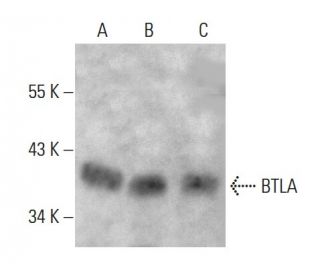 BTLA Antibody (4B8) - Western Blotting - Image 384275SAM Transcription Activation: SAM system utilizing dCas9-VP64, MS2-P65-HSF1, and sgRNA for precise gene transcription activation. 