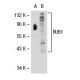 BUB1 Antibody (14H5) - Western Blotting - Image 31853