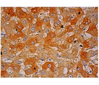BUP-1 Antibody (G-9) - Immunohistochemistry - Image 305541 