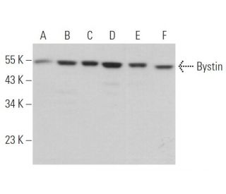 Bystin Antibody (A-10) - Western Blotting - Image 373546 