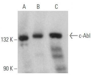 western blotting image from recommended c-Abl (8E9) monoclonal antibody replacement. Image 360842