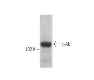 c-Abl Antibody (8E9) - Western Blotting - Image 352754Each CRISPR/Cas9 Knockout (KO) Plasmid product consists of a pool of 3 plasmids designed to ensure identification and cleavage of a specific gene for maximum knockout efficiency. Each plasmid encodes a unique 20 nt sequence derived from the GeCKO (v2) library.
