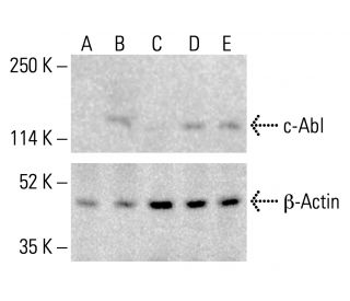 c-Abl Antibody (24-11) - Western Blotting - Image 412302
