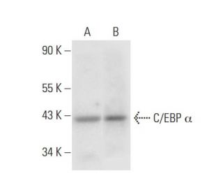 C/EBP α Antibody (G-10) - Western Blotting - Image 305843The Double Nickase Plasmid features a U6 promoter for sgRNA expression, a 20 nt targeting sequence, and a gRNA scaffold to guide Cas9n. It includes a CBh promoter for Cas9n (D10A) and puromycin resistance, GFP for transfection verification, and nuclear localization signals (NLS). The 2A peptide allows co-expression of Cas9n and Puro from a single promoter, enabling precise genome editing with reduced off-target effects.