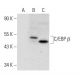 C/EBP beta Antibody (47A1) - Western Blotting - Image 67064 