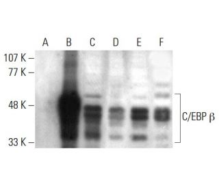 western blotting image from recommended C/EBP beta (H-7) monoclonal antibody replacement. Image 381008