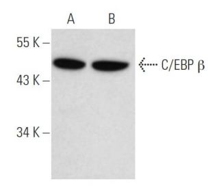 C/EBP beta Antibody (47A1) - Western Blotting - Image 17495 