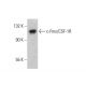 c-Fms/CSF-1R Antibody (0.N.179) - Western Blotting - Image 377041