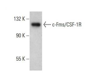 c-Fms/CSF-1R Antibody (5J15) - Western Blotting - Image 377042