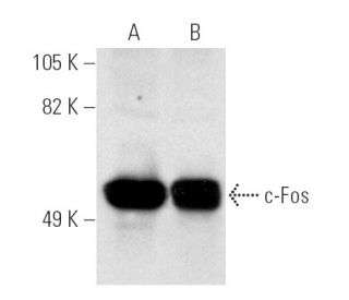 c-Fos Antibody (6-2H-2F) - Western Blotting - Image 750 