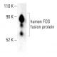 c-Fos Antibody (6-2H-2F) - Western Blotting - Image 401862