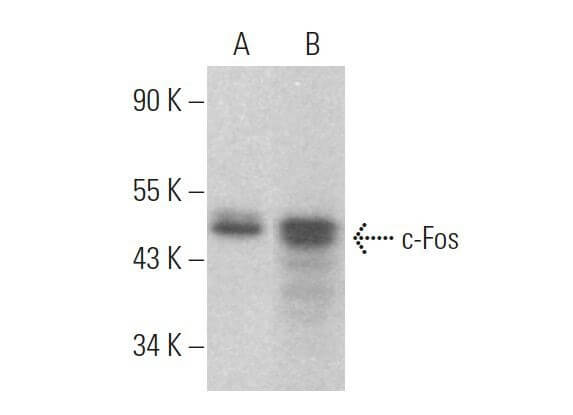 【超歓迎】 c-fos-antibody-c-10-western- ボール